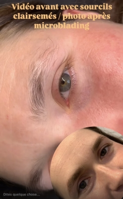 MICROBLADING SUR SOURCILS CLAIRSEMÉS
