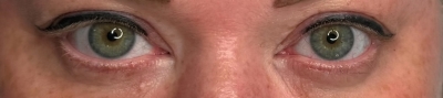 Yeux de biche 
