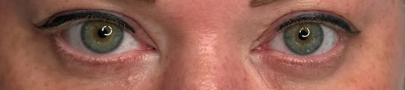Yeux de biche 